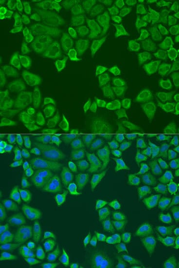 PABPC4 Antibody