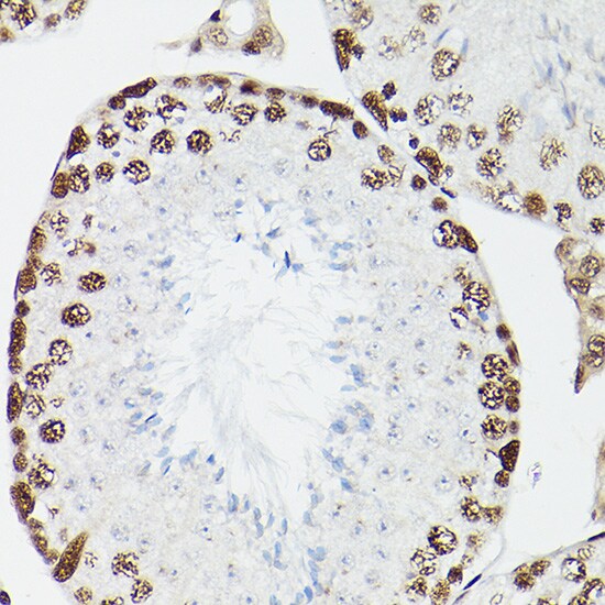 CPSF6 Antibody