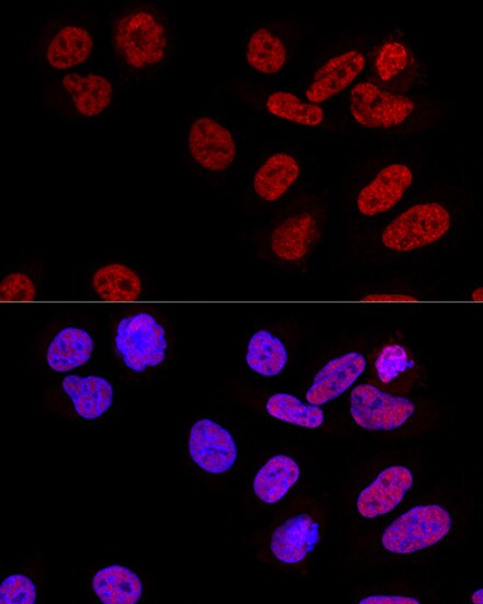 CPSF6 Antibody