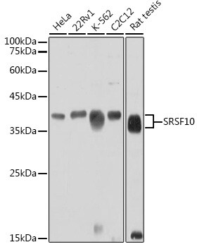 FUSIP1 Antibody