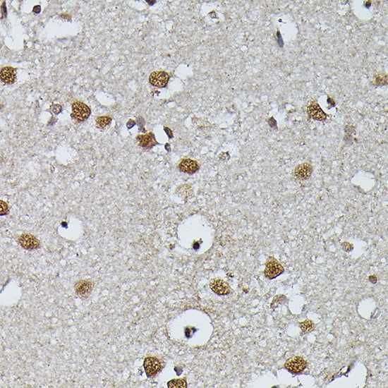 PRPF4 Antibody