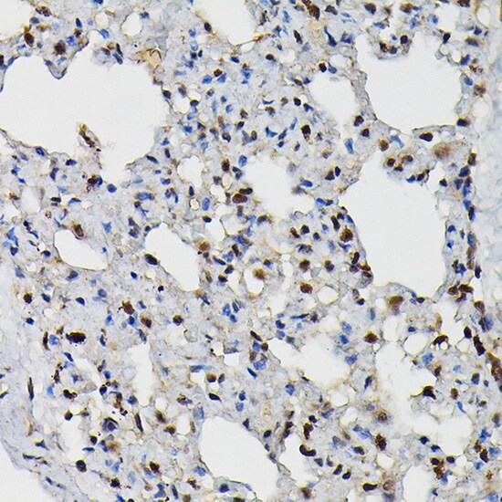 PRPF4 Antibody