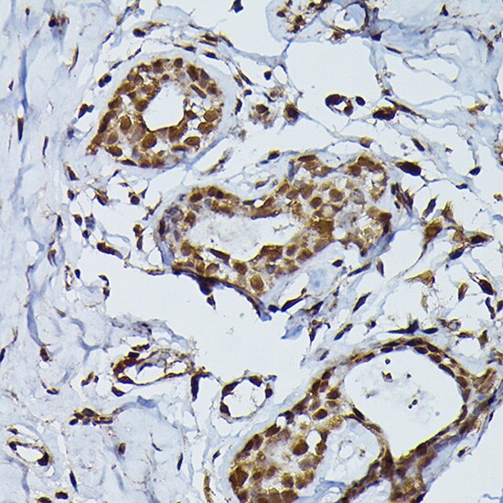 PRPF4 Antibody