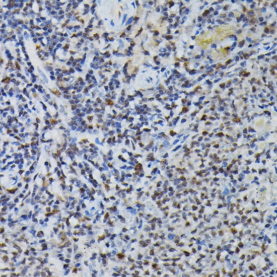 PRPF4 Antibody