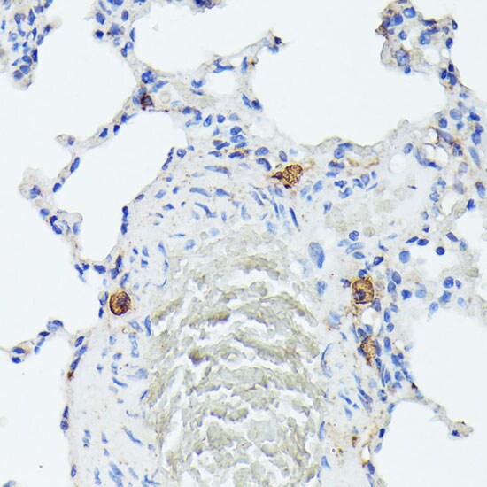 TIAL1 Antibody