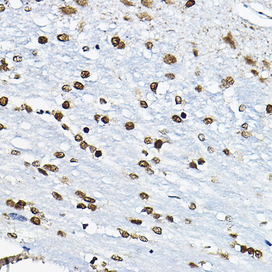 CIRBP Antibody