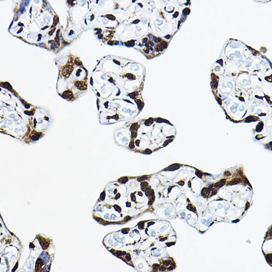 CIRBP Antibody