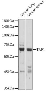 TAP1 Antibody