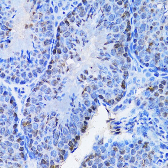 Cbx8 Antibody