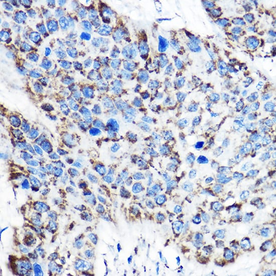OAT Antibody
