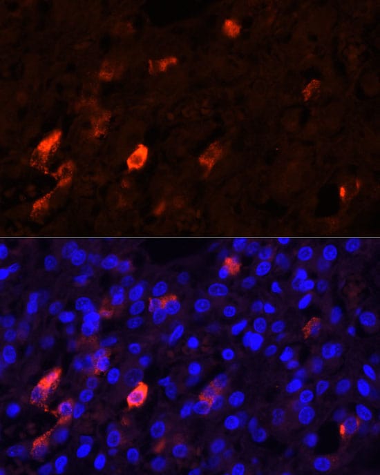 Proenkephalin Antibody