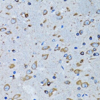 Arginyl tRNA synthetase Antibody