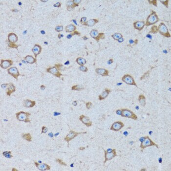 Arginyl tRNA synthetase Antibody