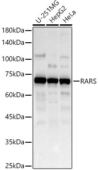 Arginyl tRNA synthetase Antibody