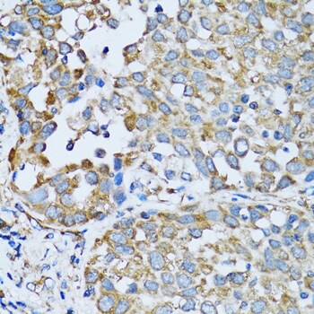 Arginyl tRNA synthetase Antibody