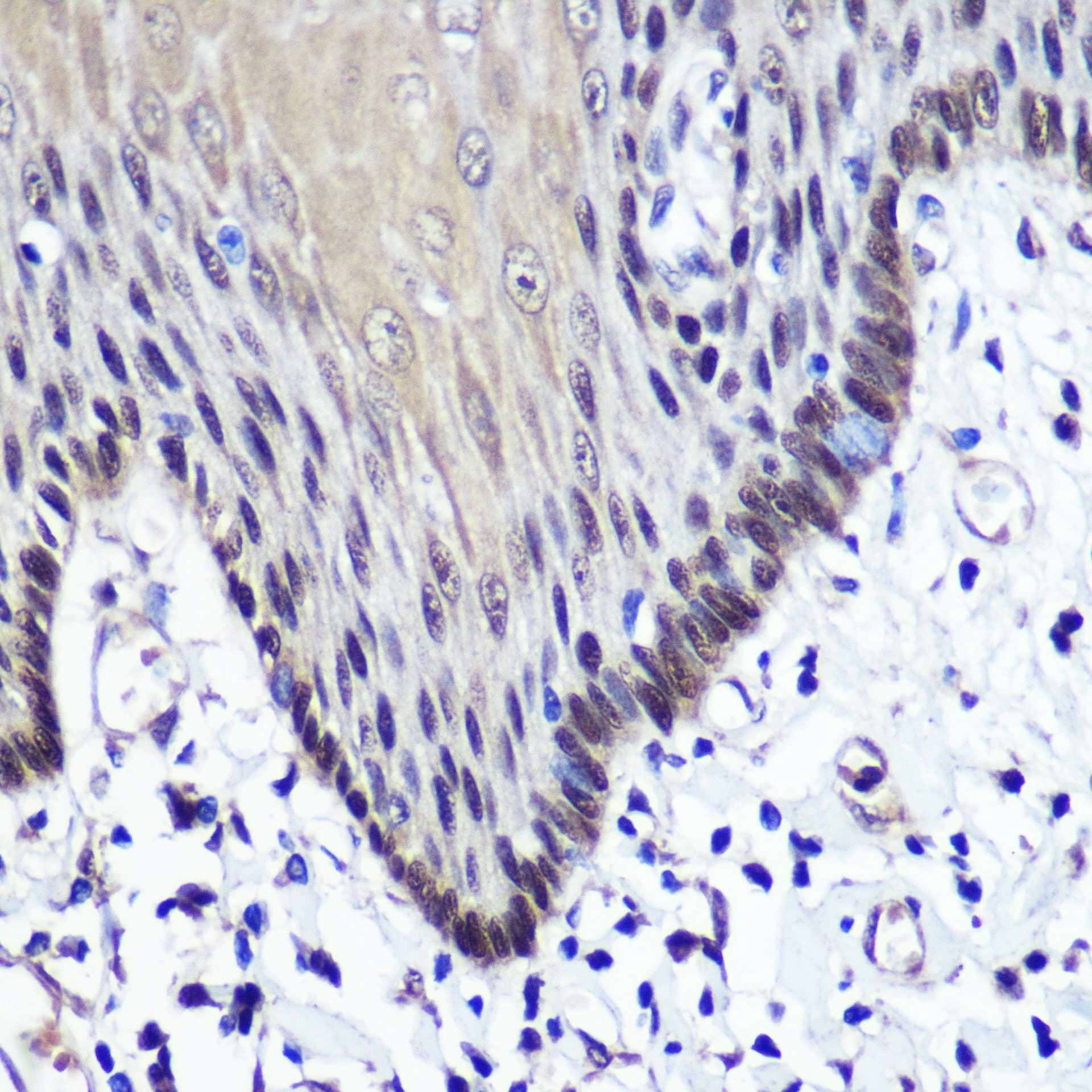Transketolase Antibody