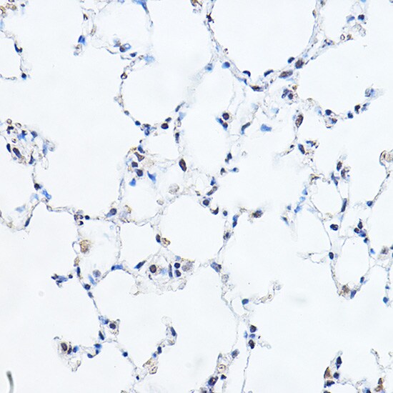 GAS41 Antibody