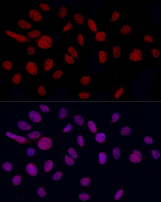 GAS41 Antibody