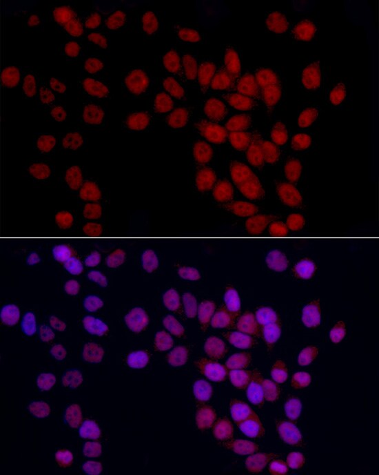 GAS41 Antibody