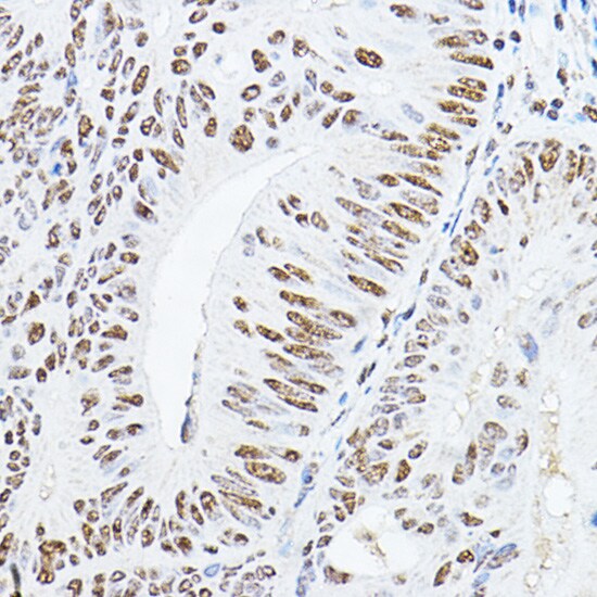 GAS41 Antibody