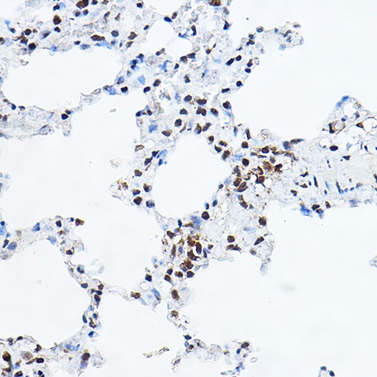 GAS41 Antibody