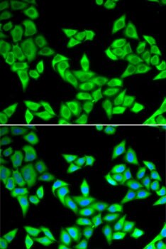 CIAPIN1 Antibody