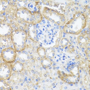 Argininosuccinate Lyase Antibody