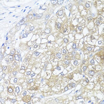 Argininosuccinate Lyase Antibody