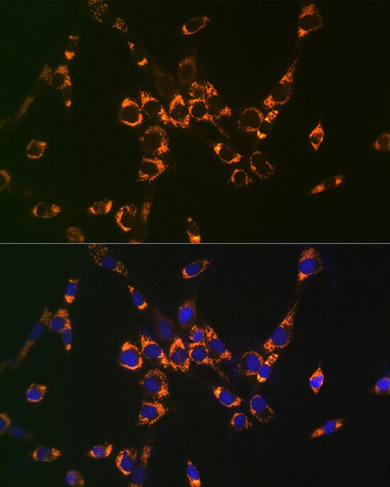 Argininosuccinate Lyase Antibody