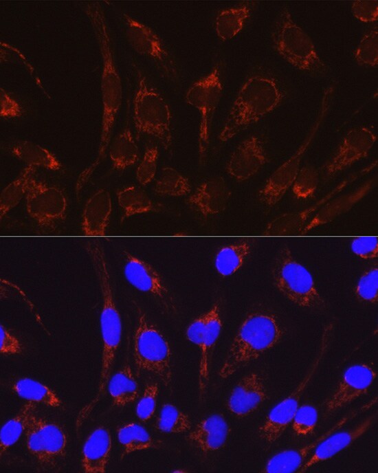 CRAT Antibody