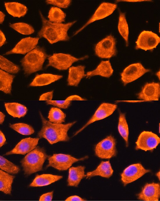 DTYMK Antibody