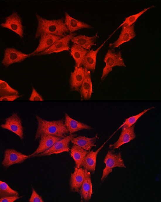 Methionine Sulfoxide Reductase A Antibody
