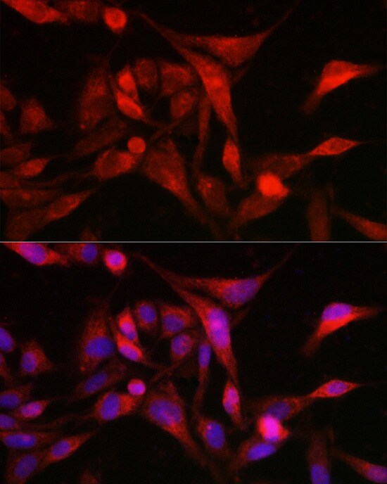 Methionine Sulfoxide Reductase A Antibody
