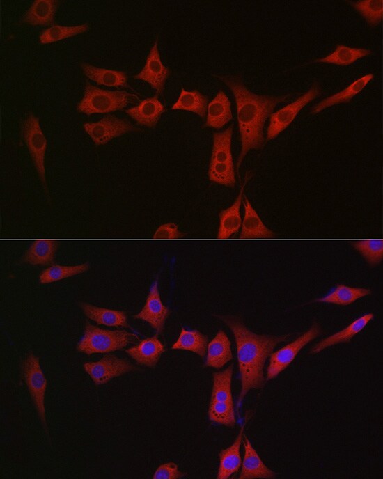 Methionine Sulfoxide Reductase A Antibody