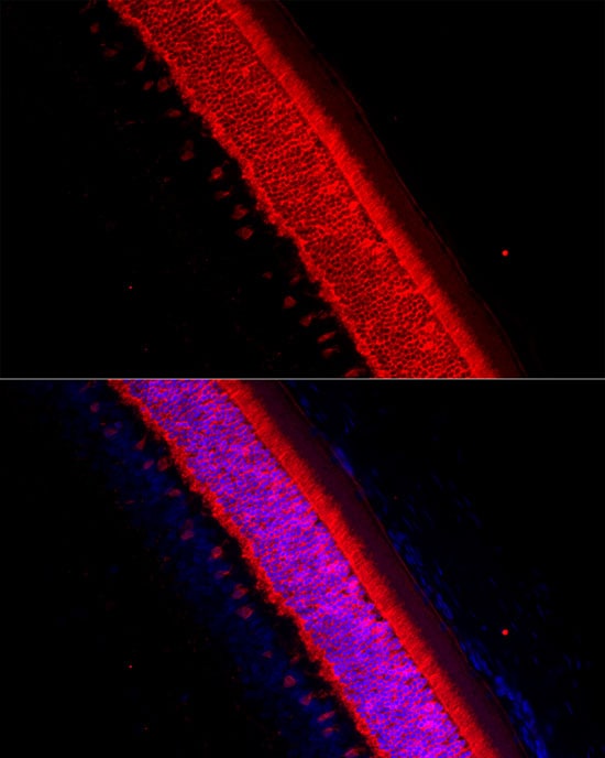 Recoverin Antibody