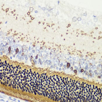Recoverin Antibody