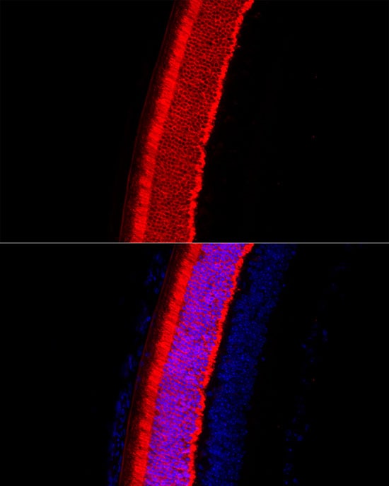 Recoverin Antibody