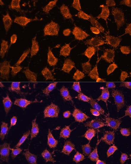 RPL11 Antibody