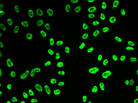 U1A Antibody