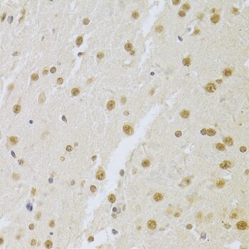U1A Antibody