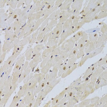 U1A Antibody