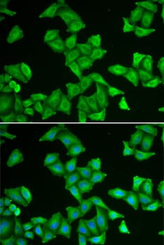 COX5A Antibody
