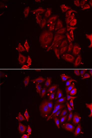 ADE2 Antibody