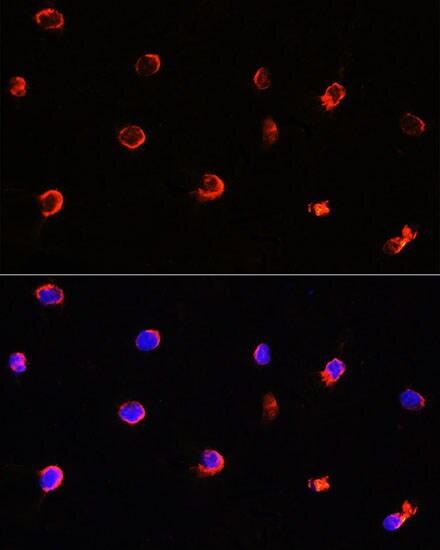 AIPL1 Antibody