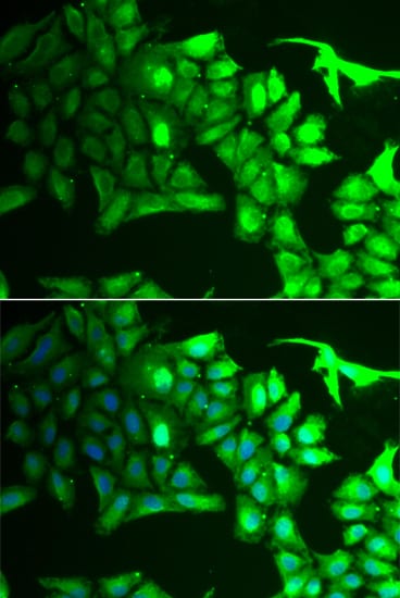AIPL1 Antibody