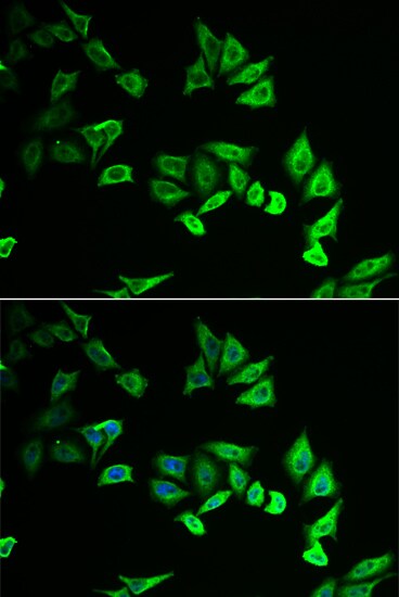 Myozenin 2 Antibody