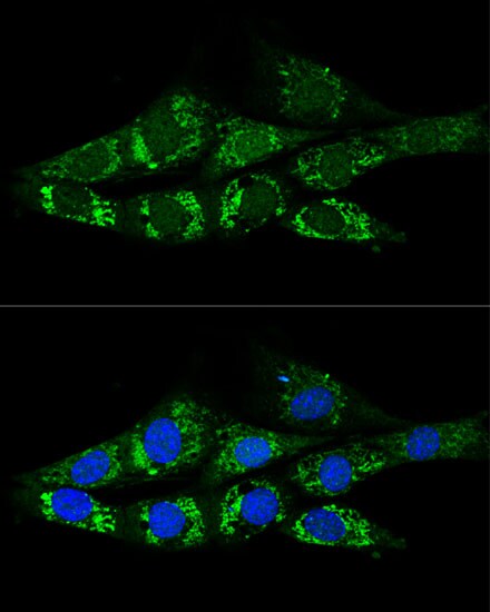 Acetyl CoA synthetase Antibody