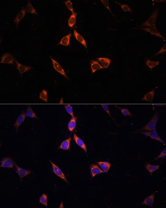 Acetyl CoA synthetase Antibody