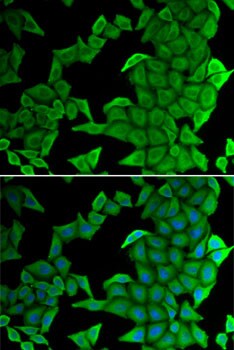 SMYD2 Antibody