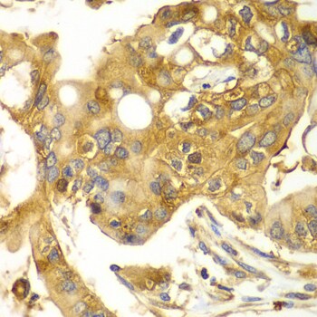 Calpain S1 Antibody